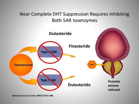 finasteride moa and prostate cancer